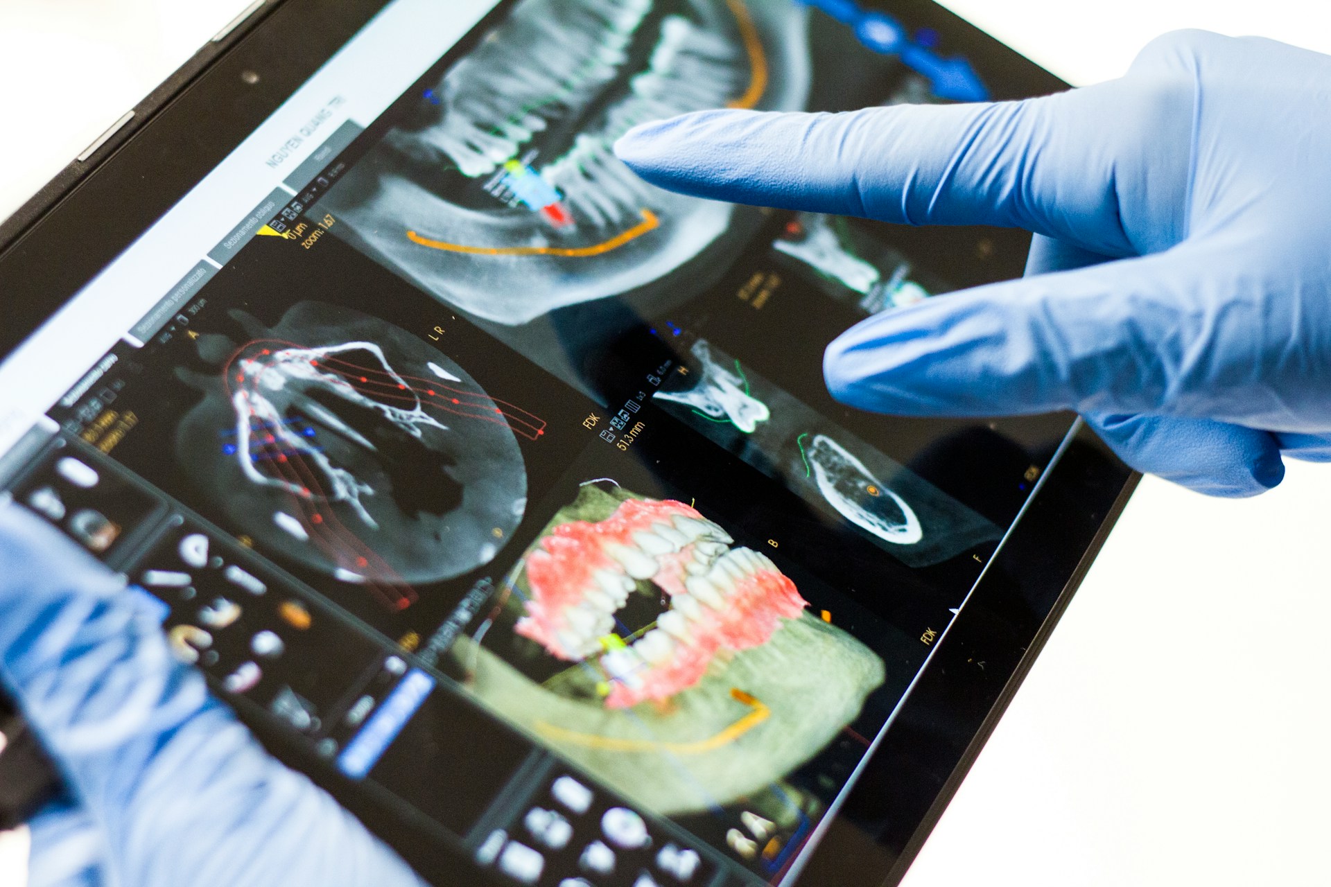 dental insurance treatment plan